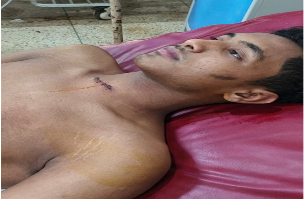 ফেঞ্চুগঞ্জে সালিশ বৈঠকে রক্তক্ষয়ী হামলা: যুবকের শ্বাসনালী কেটে হত্যার চেষ্টা