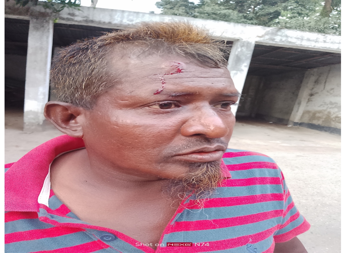 জায়গা-জমির বিরোধে মুরাদনগরে সৎ ভাইয়ের পৈশাচিক হামলা; হাসপাতালে কাতরাচ্ছেন ভুক্তভোগী